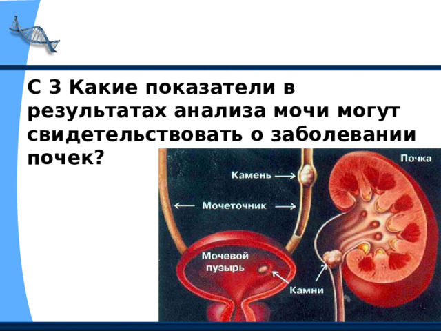 С 3 Какие показатели в результатах анализа мочи могут свидетельствовать о заболевании почек? 