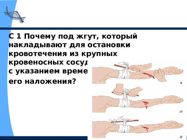С 1 Почему под жгут, который накладывают для остановки кровотечения из крупных кровеносных сосудов, кладут записку с указанием времени его наложения?  