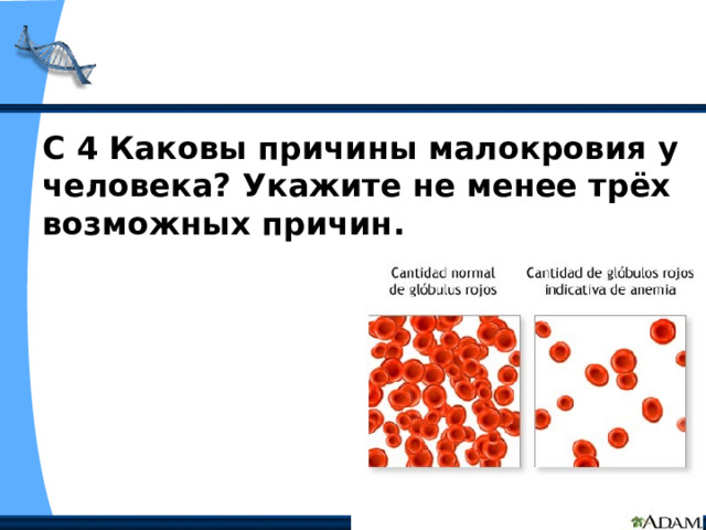 С 4 Каковы причины малокровия у человека? Укажите не менее трёх возможных причин.  