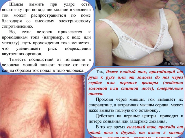 Шансы выжить при ударе есть, поскольку при попадании молнии в человека ток может распространиться по коже благодаря ее высокому электрическому сопротивлению. Но, если человек прикасается к проводникам тока (например, к воде или металлу), путь прохождения тока меняется, что увеличивает риск повреждения внутренних органов. Тяжесть последствий от попадания в человека молний зависит также от того, каким образом ток попал в тело человека. Так, даже слабый ток, проходящий от руки к руке или от головы до ног через сердце или нервные центры (особенно головной или спинной мозг), смертельно опасен. Проходя через мышцы, ток вызывает их сокращение, а затрагивая мышцы сердца, может даже вызвать полную его остановку. Действуя на нервные центры, приводит к потере сознания или задержке дыхания. В то же время сильный ток, проходя от одной ноги к другой, от плеча к кисти, минуя жизненно важные центры, не вызовет серьезных последствий.  