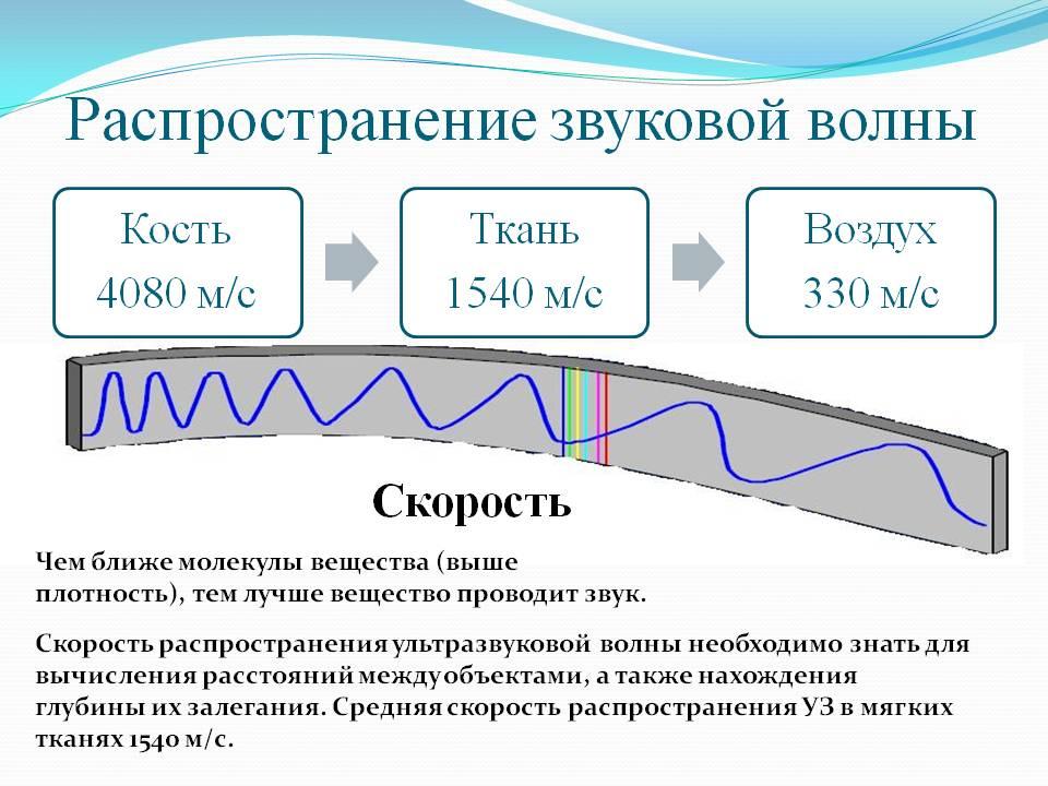 Схема прохождения звуковой волны