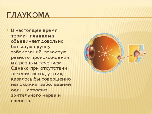 глаукома В настоящее время термин глаукома  объединяет довольно большую группу заболеваний, зачастую разного происхождения и с разным течением. Однако при отсутствии лечения исход у этих, казалось бы совершенно непохожих, заболеваний один - атрофия зрительного нерва и слепота. 