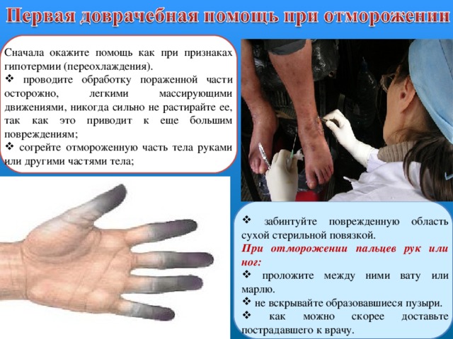 Сначала окажите помощь как при признаках гипотермии (переохлаждения).  проводите обработку пораженной части осторожно, легкими массирующими движениями, никогда сильно не растирайте ее, так как это приводит к еще большим повреждениям;  согрейте отмороженную часть тела руками или другими частями тела;  забинтуйте поврежденную область сухой стерильной повязкой. При отморожении пальцев рук или ног:   проложите между ними вату или марлю.  не вскрывайте образовавшиеся пузыри.  как можно скорее доставьте пострадавшего к врачу. 