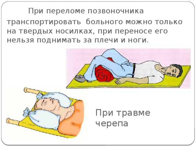 При переломе позвоночника транспортировать больного можно только на твердых носилках, при переносе его нельзя поднимать за плечи и ноги. При травме черепа 
