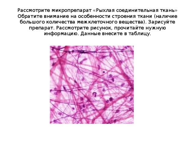 Рыхлая соединительная ткань рисунок