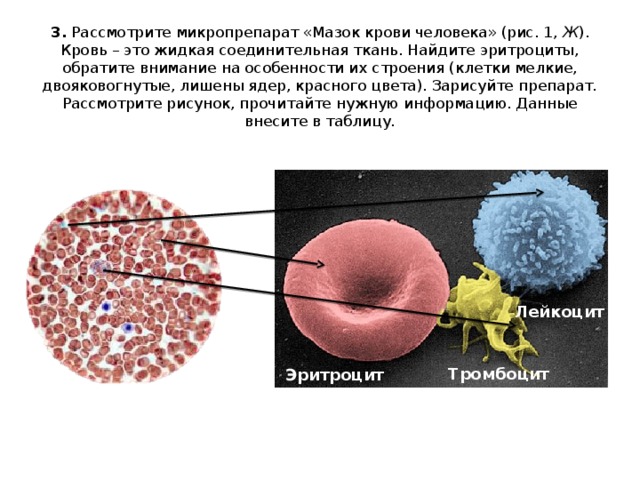 3. Рассмотрите микропрепарат «Мазок крови человека» (рис. 1, Ж ). Кровь – это жидкая соединительная ткань. Найдите эритроциты, обратите внимание на особенности их строения (клетки мелкие, двояковогнутые, лишены ядер, красного цвета). Зарисуйте препарат. Рассмотрите рисунок, прочитайте нужную информацию. Данные внесите в таблицу.   Лейкоцит Тромбоцит Эритроцит 