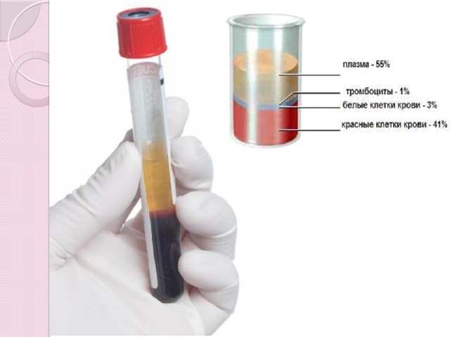 Сыворотка крови биологических. Плазма крови после центрифугирования. Плазма в пробирке после центрифугирования. Сыворотка крови и плазма крови. Сыворотка крови после центрифугирования.