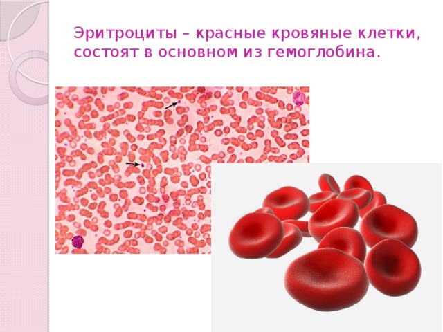 Красные кровяные клетки. Эритроциты красные кровяные клетки гемоглобин. Выход гемоглобина из эритроцитов. Эритроциты состоят из клеток.