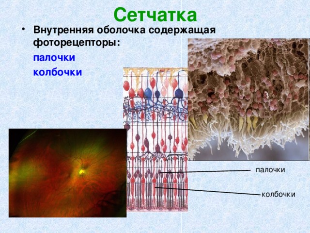 Сетчатка Внутренняя оболочка содержащая фоторецепторы:  палочки    колбочки палочки колбочки 