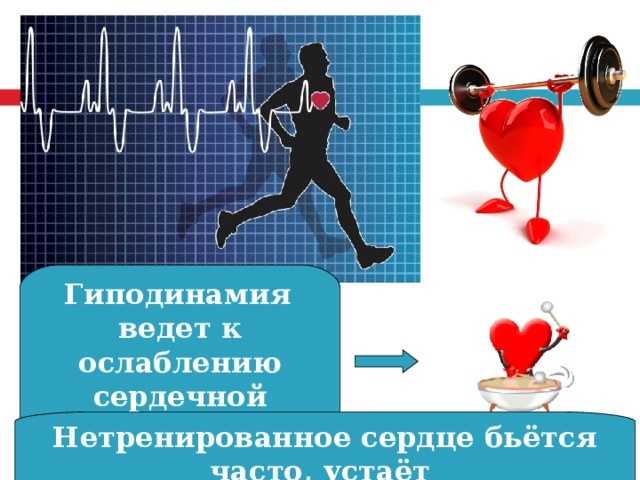  Гиподинамия ведет к ослаблению сердечной мышцы Нетренированное сердце бьётся часто, устаёт 