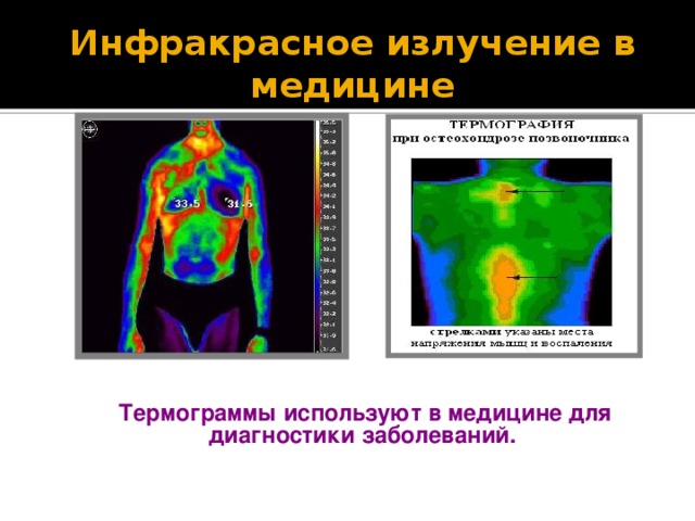 Инфракрасное излучение в медицине презентация