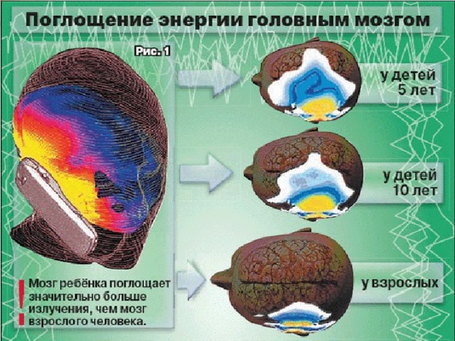 Влияние на активность мозга сотового телефона. Поглощение энергии головным мозгом. Влияние гаджетов на мозг. Влияние излучения телефона на мозг.