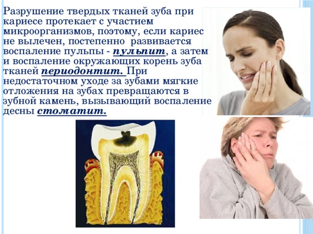 Разрушение твердых тканей зуба при кариесе протекает с участием микроорганизмов, поэтому, если кариес не вылечен, постепенно развивается воспаление пульпы - пульпит , а затем и воспаление окружающих корень зуба тканей периодонтит. При недостаточном уходе за зубами мягкие отложения на зубах превращаются в зубной камень, вызывающий воспаление десны стоматит. 