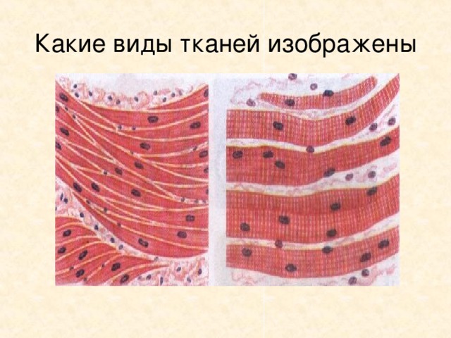 Какие виды тканей изображены 