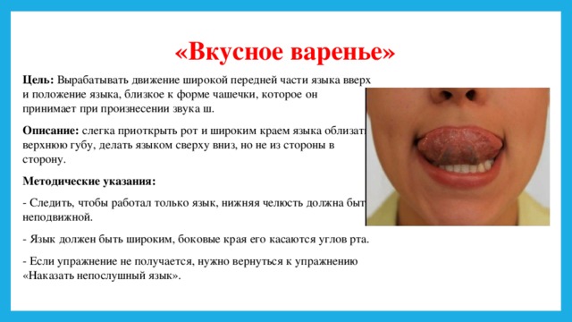 Вкусное варенье артикуляционная гимнастика картинки