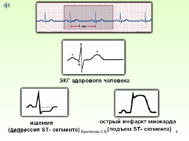26.02.17  Братякова С.Б, 