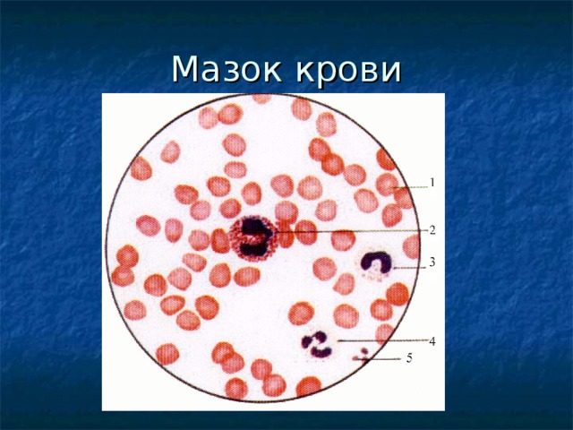 Изучите мазок крови человека к рисунку сделайте обозначения