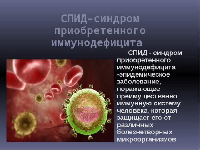 Спид это. Синдром приобретенного иммунодефицита человека. СПИД синдром приобретенного иммунодефицита. СПИД это вирусное заболевание. Синдром приобретённого иммунного дефицита.