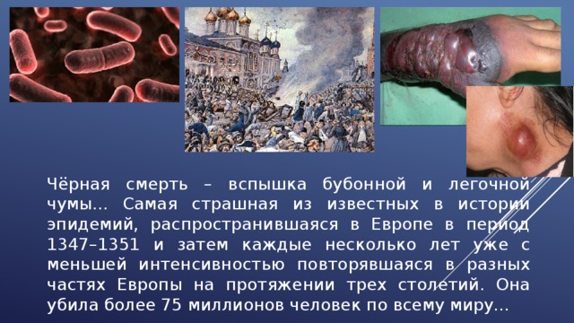 Чёрная смерть – вспышка бубонной и легочной чумы... Самая страшная из известных в истории эпидемий, распространившаяся в Европе в период 1347–1351 и затем каждые несколько лет уже с меньшей интенсивностью повторявшаяся в разных частях Европы на протяжении трех столетий. Она убила более 75 миллионов человек по всему миру… 