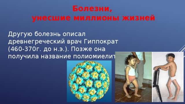Болезни, унесшие миллионы жизней Другую болезнь описал древнегреческий врач Гиппократ (460-370г. до н.э.). Позже она получила название полиомиелит. 