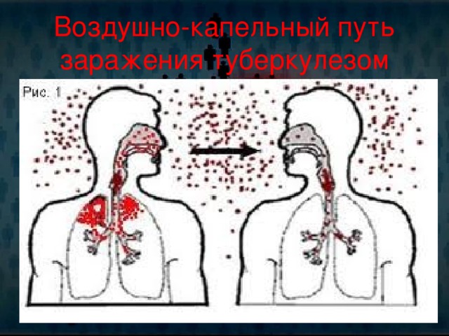 Бешенство воздушно капельным. Источники и пути заражения туберкулезом. Воздушно-капельный путь. Туберкулёз воздушно капельным. Воздушно капельный путь передачи.