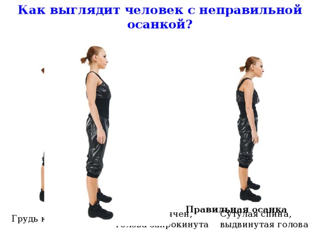 Напиши как выглядит человек с правильной осанкой