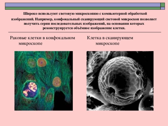   Широко используют световую микроскопию с компьютерной обработкой изображений. Например, конфокальный сканирующий световой микроскоп позволяет получить серии последовательных изображений, на основании которых реконструируется объёмное изображение клетки. Раковые клетки в конфокальном микроскопе Клетка в сканирующем микроскопе 