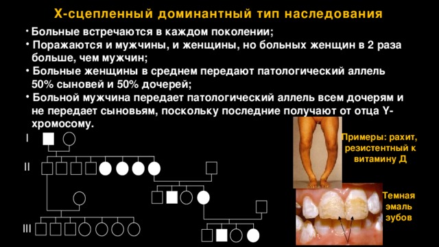 Сцепленно с х хромосомой наследуется заболевание. Темная эмаль зубов Тип наследования признака. Болезни с х сцепленным доминантным типом наследования. Признаки х сцепленного типа наследования. Темная эмаль зубов Тип наследования.