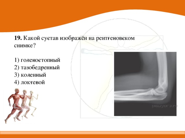 19. Какой су­став изоб­ражён на рент­ге­нов­ском сним­ке?   1) го­ле­но­стоп­ный 2) та­зо­бед­рен­ный 3) ко­лен­ный 4) лок­те­вой 