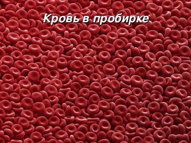 Кровь в пробирке  