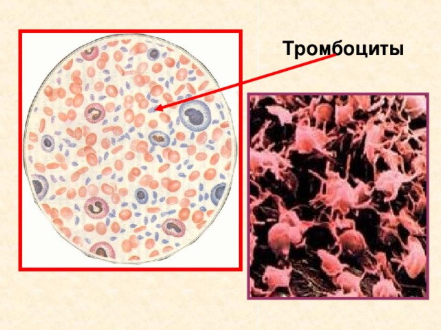 Тромбоциты  