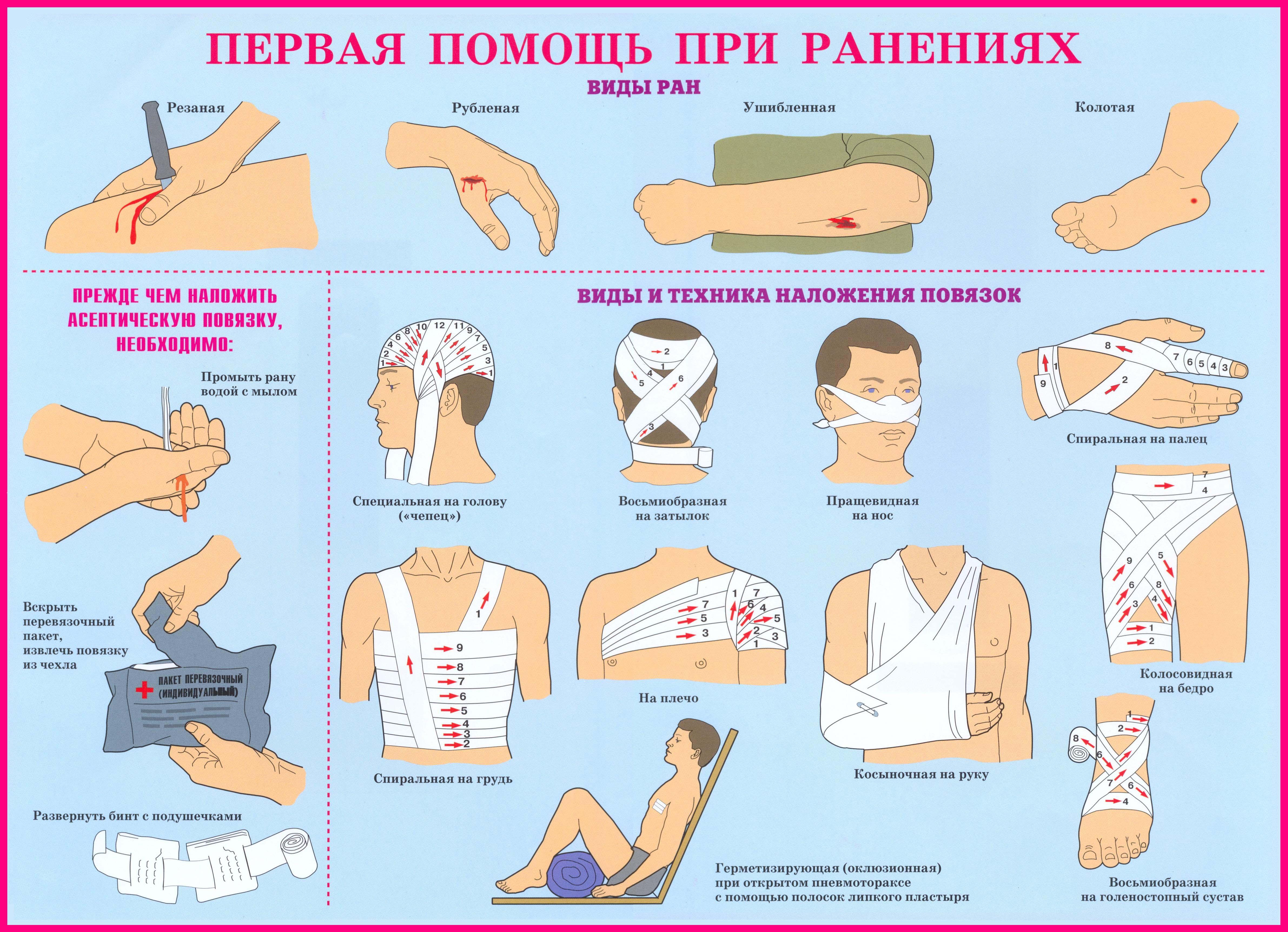 Презентация виды ран и общие правила оказания первой медицинской помощи