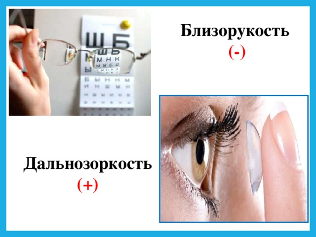 Близорукость (-) Дальнозоркость (+)
