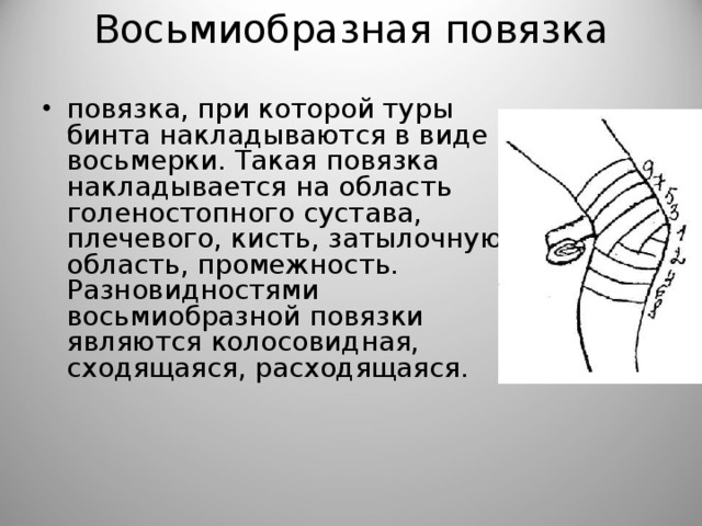 Наложение повязки на коленный сустав. Правила наложения восьмиобразной повязки. Техника наложения восьмиобразной повязки. Черепашья повязка на коленный сустав алгоритм. Восьмиобразная повязка на коленный сустав алгоритм.