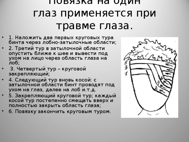 При ранениях глаз или век. Наложить повязку при травме глаза. Повязка при ранении глаза. Наложение повязки при ранении глаза. При травме глаза, повязка накладывается.