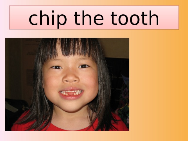 chip the tooth 