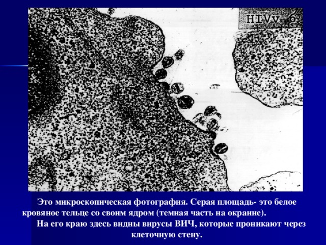 Это микроскопическая фотография. Серая площадь- это белое кровяное тельце со своим ядром (темная часть на окраине). На его краю здесь видны вирусы ВИЧ, которые проникают через клеточную стену.  