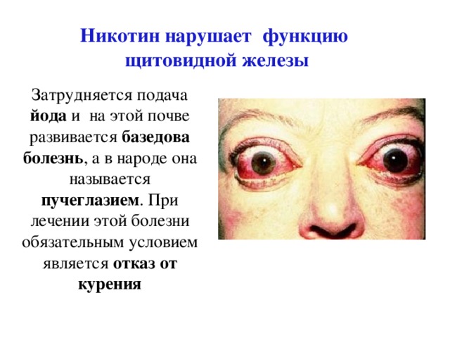 Никотин нарушает функцию  щитовидной железы Затрудняется подача йода и  на этой почве развивается базедова  болезнь , а в народе она называется пучеглазием . При лечении этой болезни обязательным условием является отказ  от  курения 