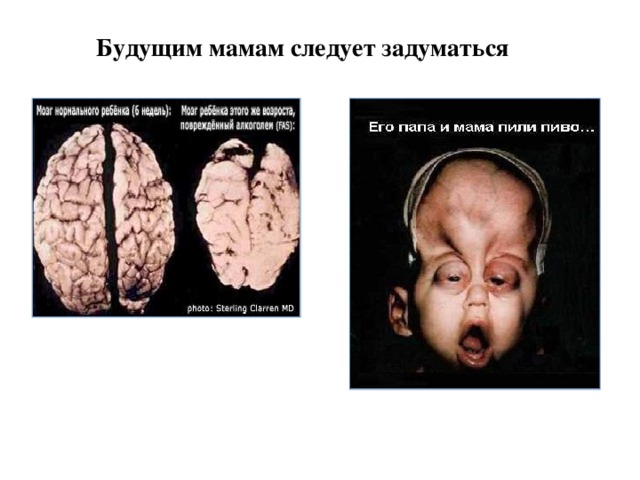 Будущим мамам следует задуматься 