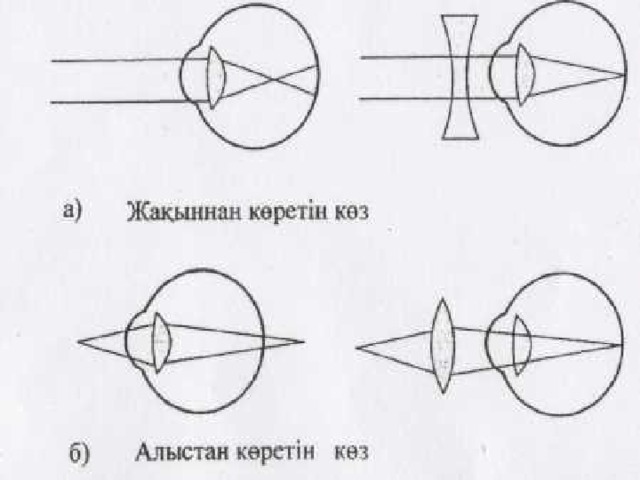 Көз оптикалық жүйе презентация