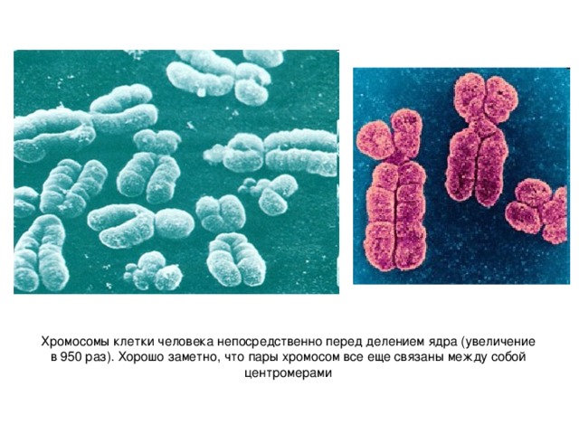 Хромосомы клетки человека непосредственно перед делением ядра (увеличение в 950 раз). Хорошо заметно, что пары хромосом все еще связаны между собой центромерами 