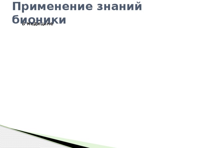 Применение знаний бионики В медицине В медицине В транспорте В транспорте В архитектуре В архитектуре В быту В быту Приборы и инструменты Приборы и инструменты 