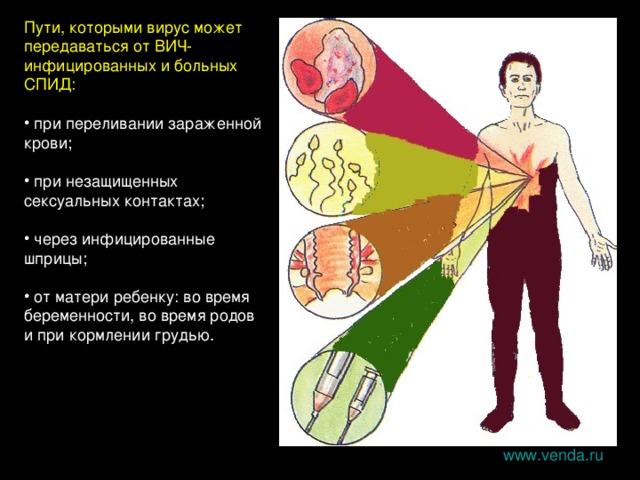 Пути, которыми вирус может передаваться от ВИЧ-инфицированных и больных СПИД:  при переливании зараженной крови;  при незащищенных сексуальных контактах;  через инфицированные шприцы;  от матери ребенку: во время беременности, во время родов и при кормлении грудью. www.venda.ru 