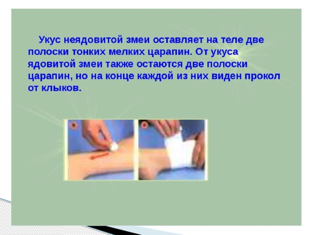 Как выглядит змеиный укус прокол после заживления