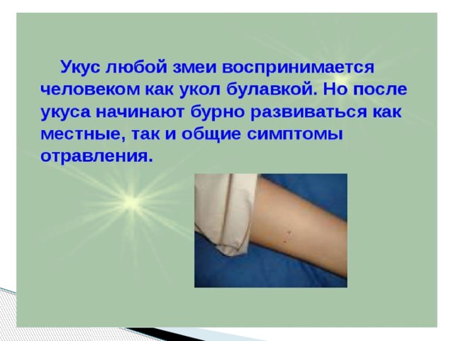Презентация на тему укусы змей