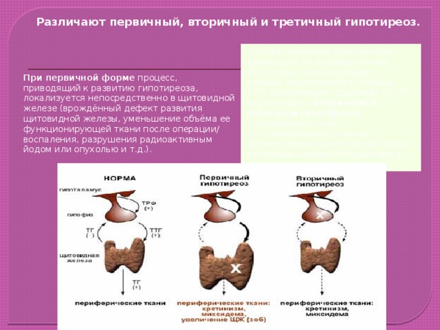 Первичный гипотиреоз презентация