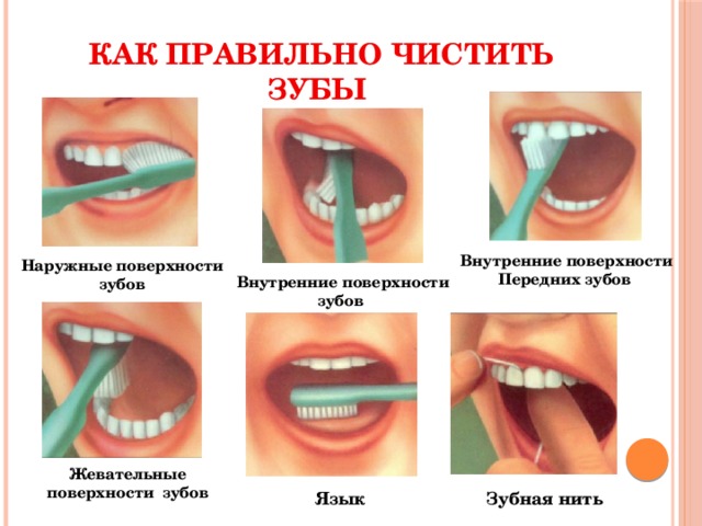 Фото как правильно чистить зубы
