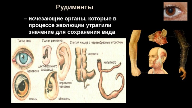 Многососковость у человека фото