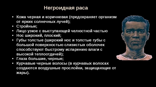 Виды негроидной расы. Разрез глазу негроидной расы. Какой разрез глаз у негроидной расы