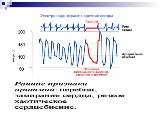 Качество пульса характеризующее состояние сосудистой стенки